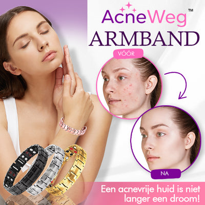 AcneWeg ™ Armband