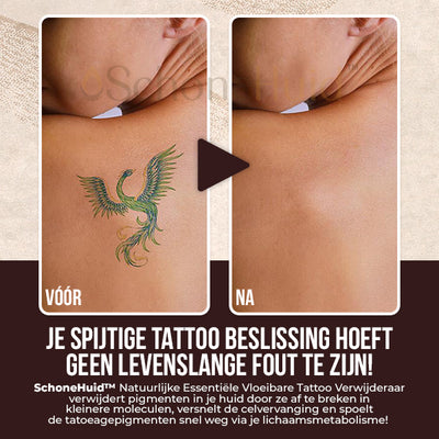 SchoneHuid™ Natuurlijke Essentiële Vloeibare Tattoo Verwijderaar