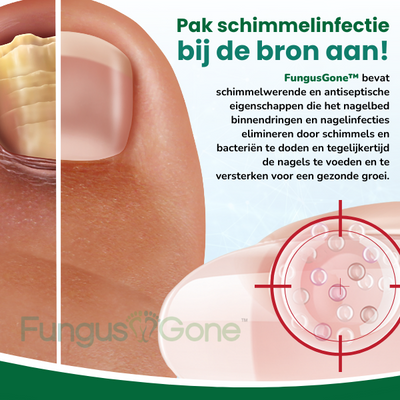 FungusGone™ Anti-Schimmel Nagelbehandeling Essentie