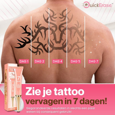 QuickErase™ Snelle & Pijnloze Tattoo Verwijderingscrème