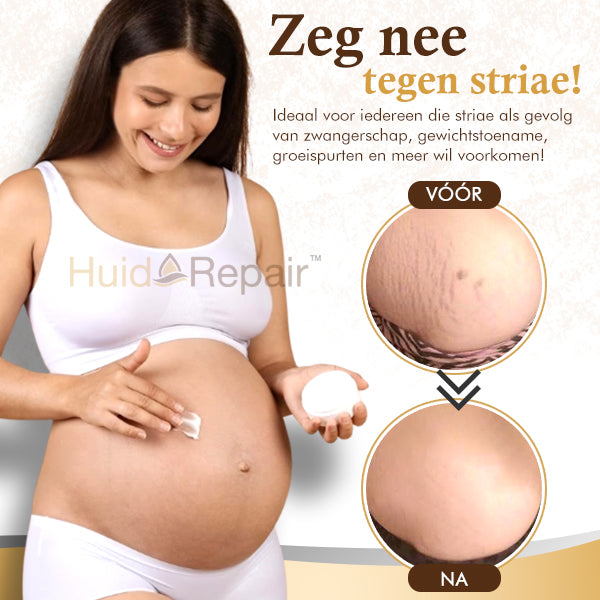 HuidRepair™Crème voor het Verwijderen van Littekens en Zwangerschapsstrepen