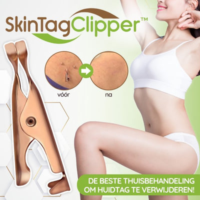 SkinTagClipper™